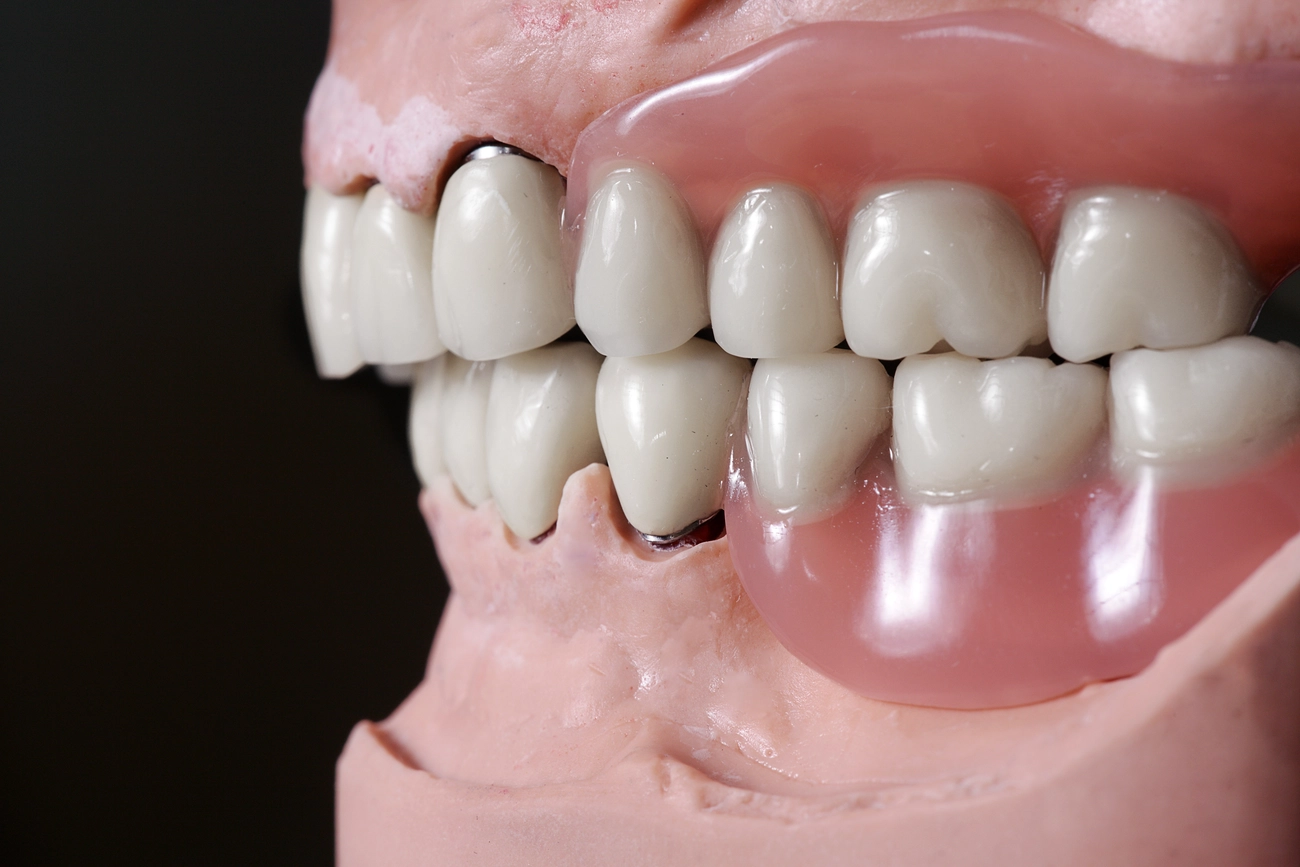 EQ Smile - Zahnarztpraxis - Menschliches Gebiss Modell Nahaufnahme 